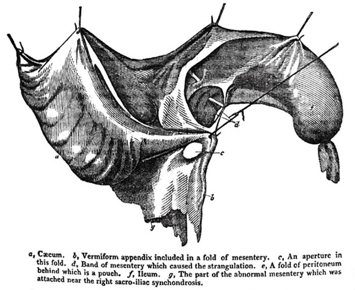 image of vermiform appendix